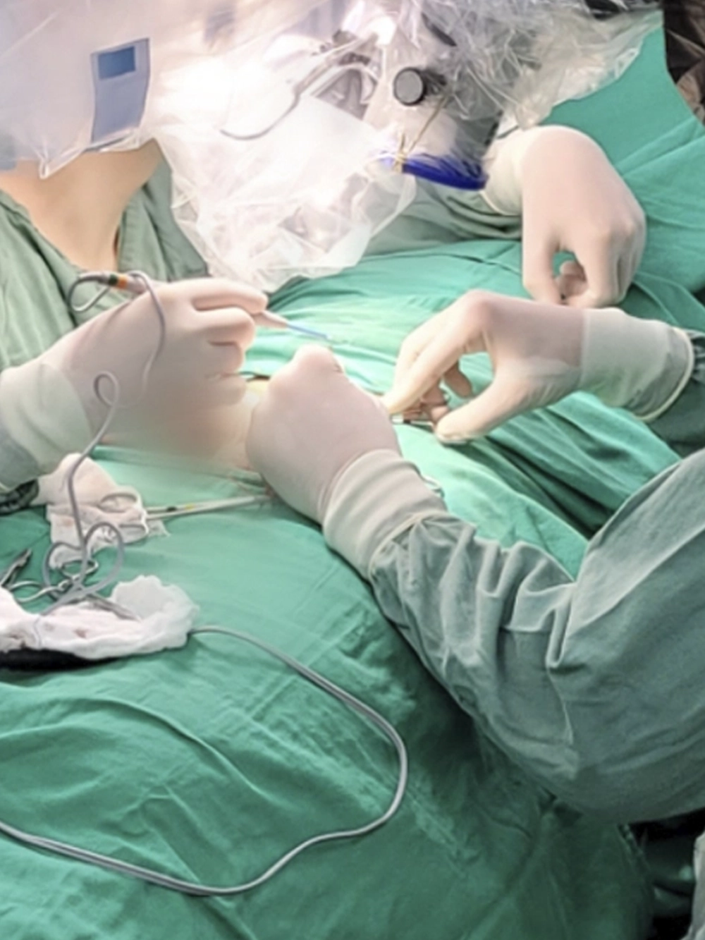 Ilustração cirurgia de fimose